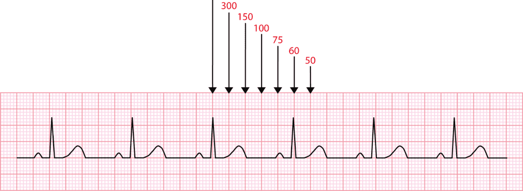 Cálculo da FC no ECG